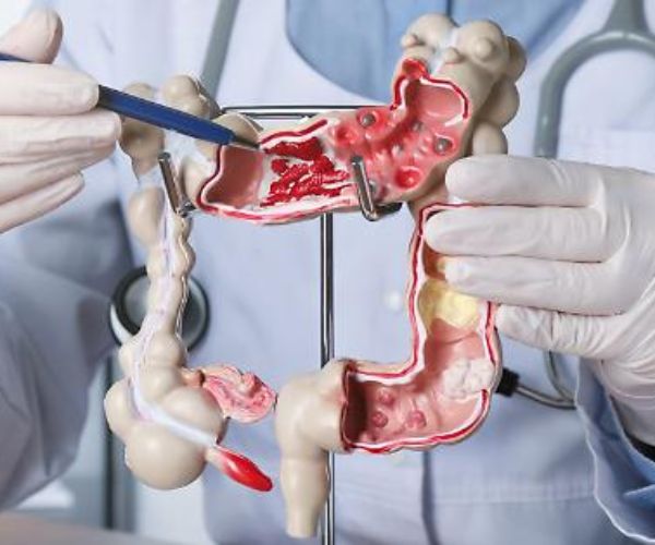 Una giornata dedicata allo screening oncologico alla Casa della salute di Galleno